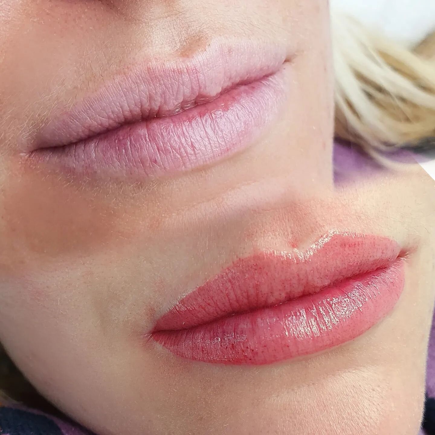 This is a sign, for you to book in to get your lips tattooed. Discover the freedom of not having to touch up your lipstick, you won't regret it! 👏
.
Book now link in bio