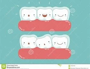 `My Invisalign Diary Weeks 1 - 21 — Homegirl Hygienist