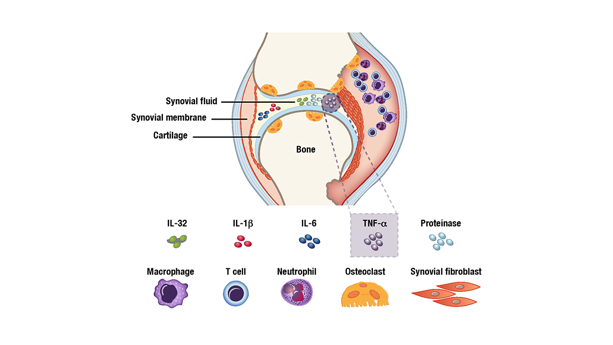 DM5_Gilead Filgotinib gfx_v33_FOR REVIEW_Page_27.png