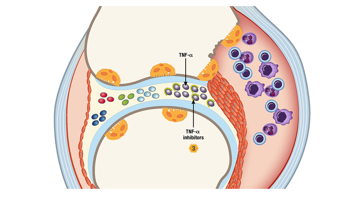 DM5_Gilead Filgotinib gfx_v33_FOR REVIEW_Page_30.png