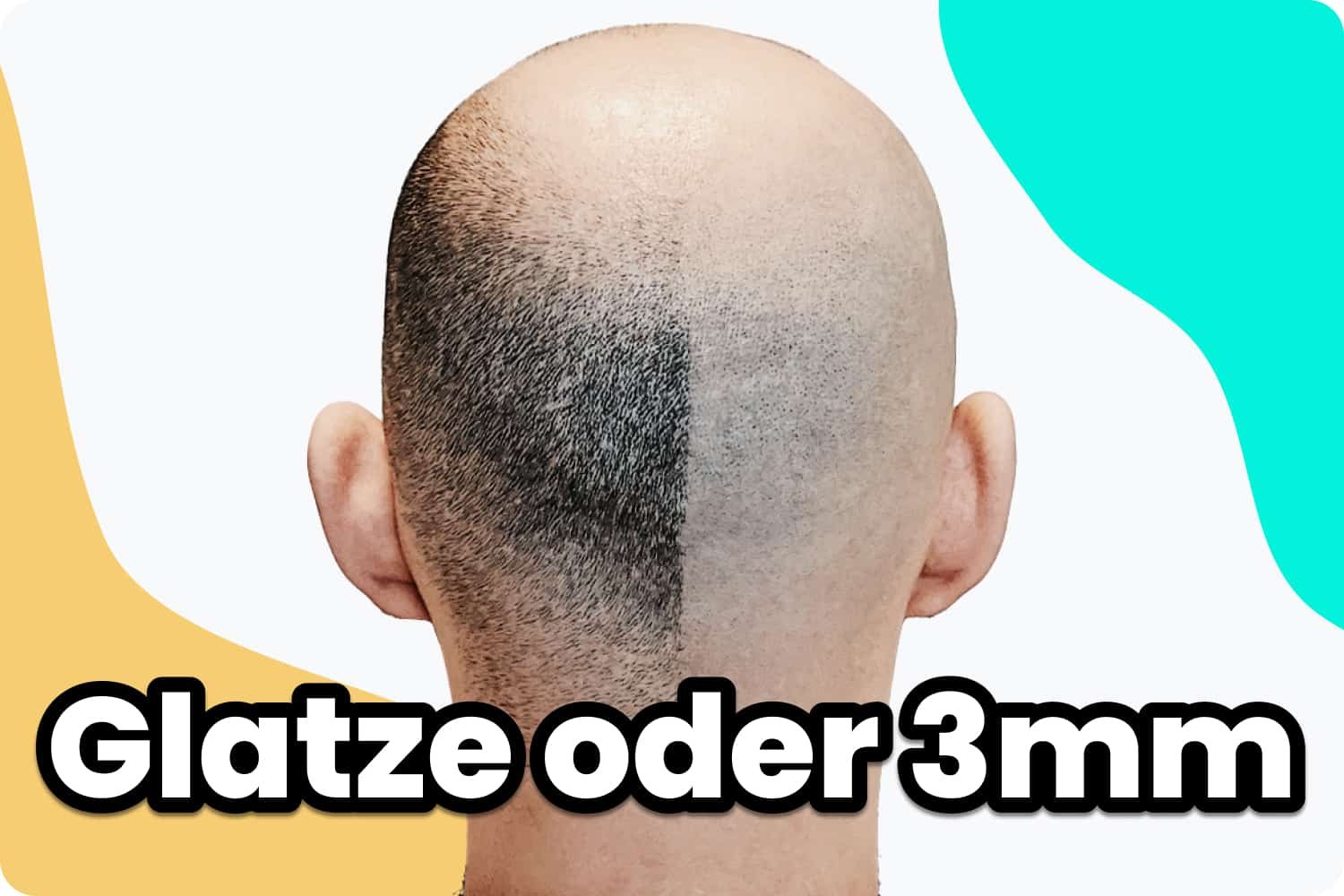 Glatze oder 3mm welcher Haarschnitt ist die richtige Wahl?