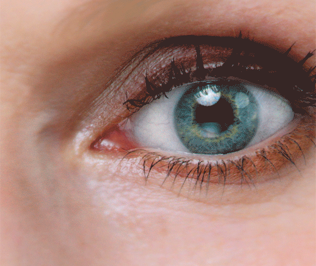 Eye Conditions & Treatments — Cataract and Eye Consultants of Michigan
