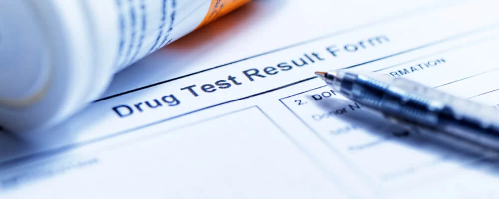 How To Pass A Drug Test: The Complete Guide