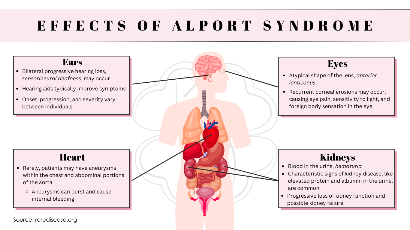 Alport Syndrome Causes Symptoms Treatment Alport Syndrome