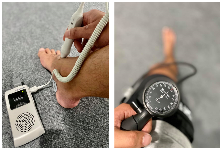What Is BFR (Blood Flow Restriction) Therapy? — Jacksonville