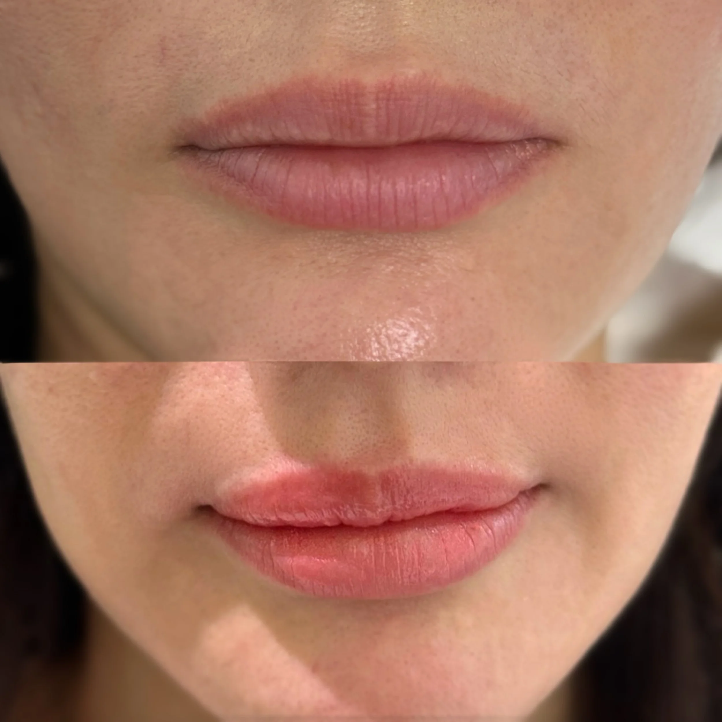 Lip_Blush_Before & After_7200.jpeg