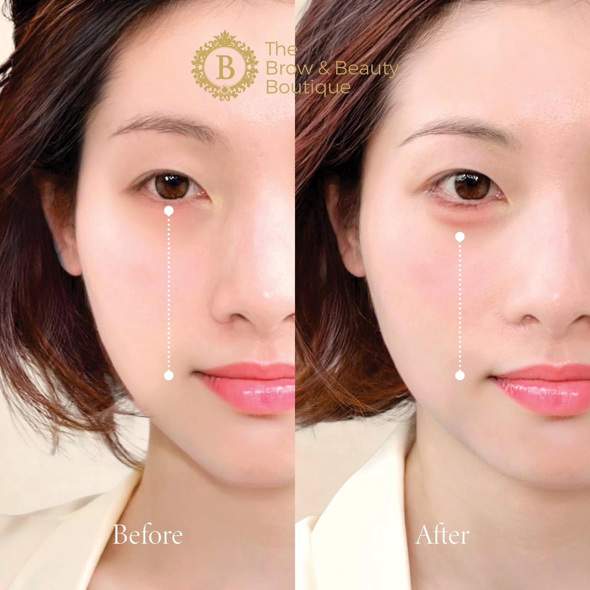 Aegyo-Sal Shading 柔雾卧蚕 - The Brow & Beauty Boutique26.jpg