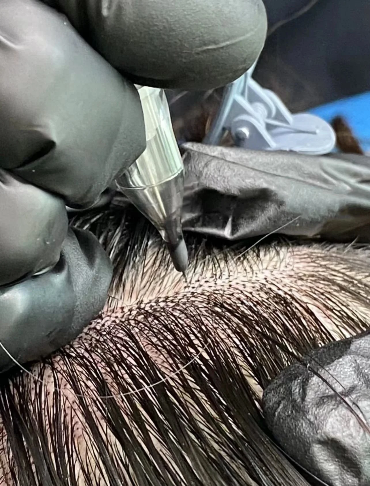 The Clarity Mirror: How to Tell If Hair Loss Is Real or Just Temporary