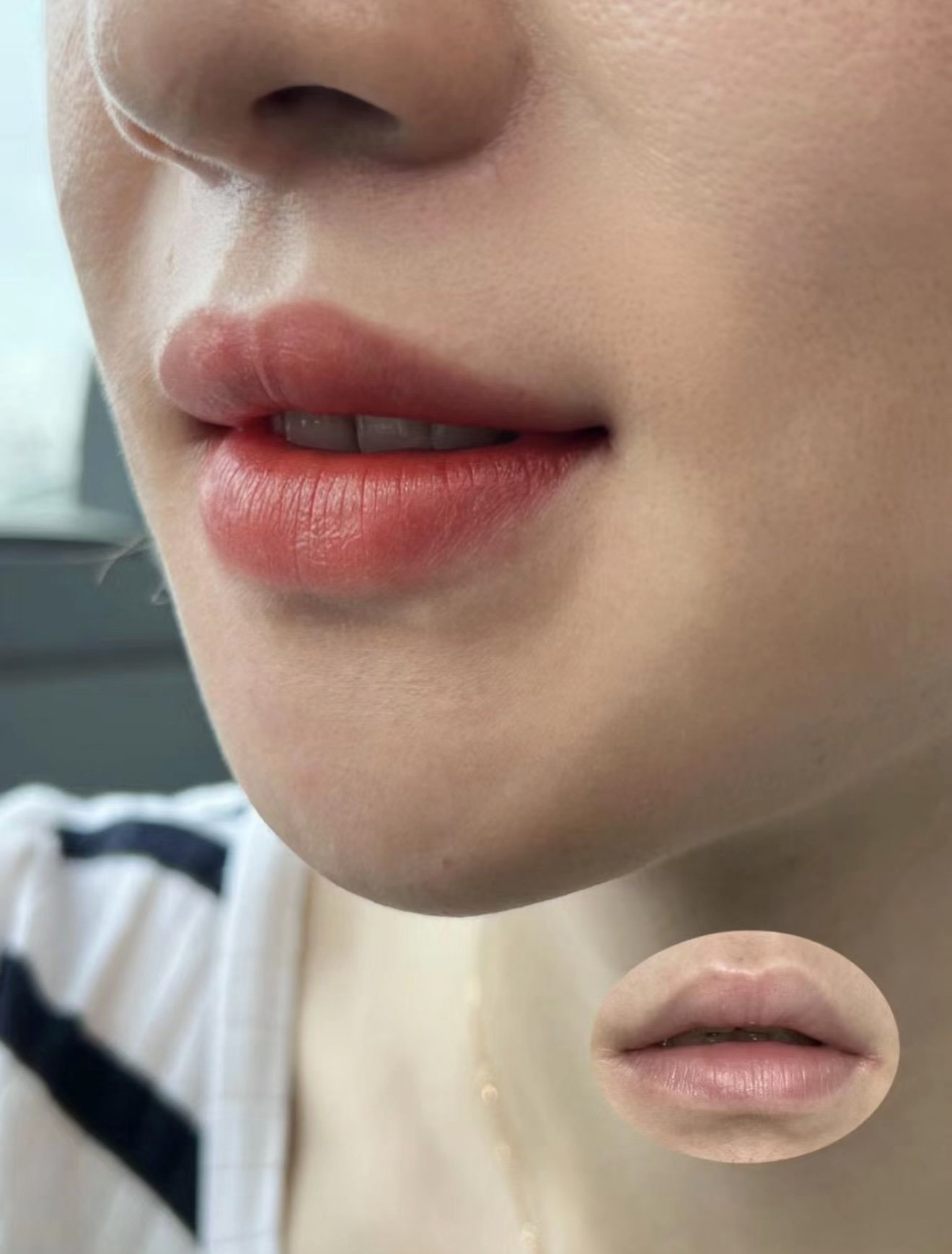 Lip Embroidery Right for You? A Guide to the Perfect Lip Blush and Lip Enhancement Options