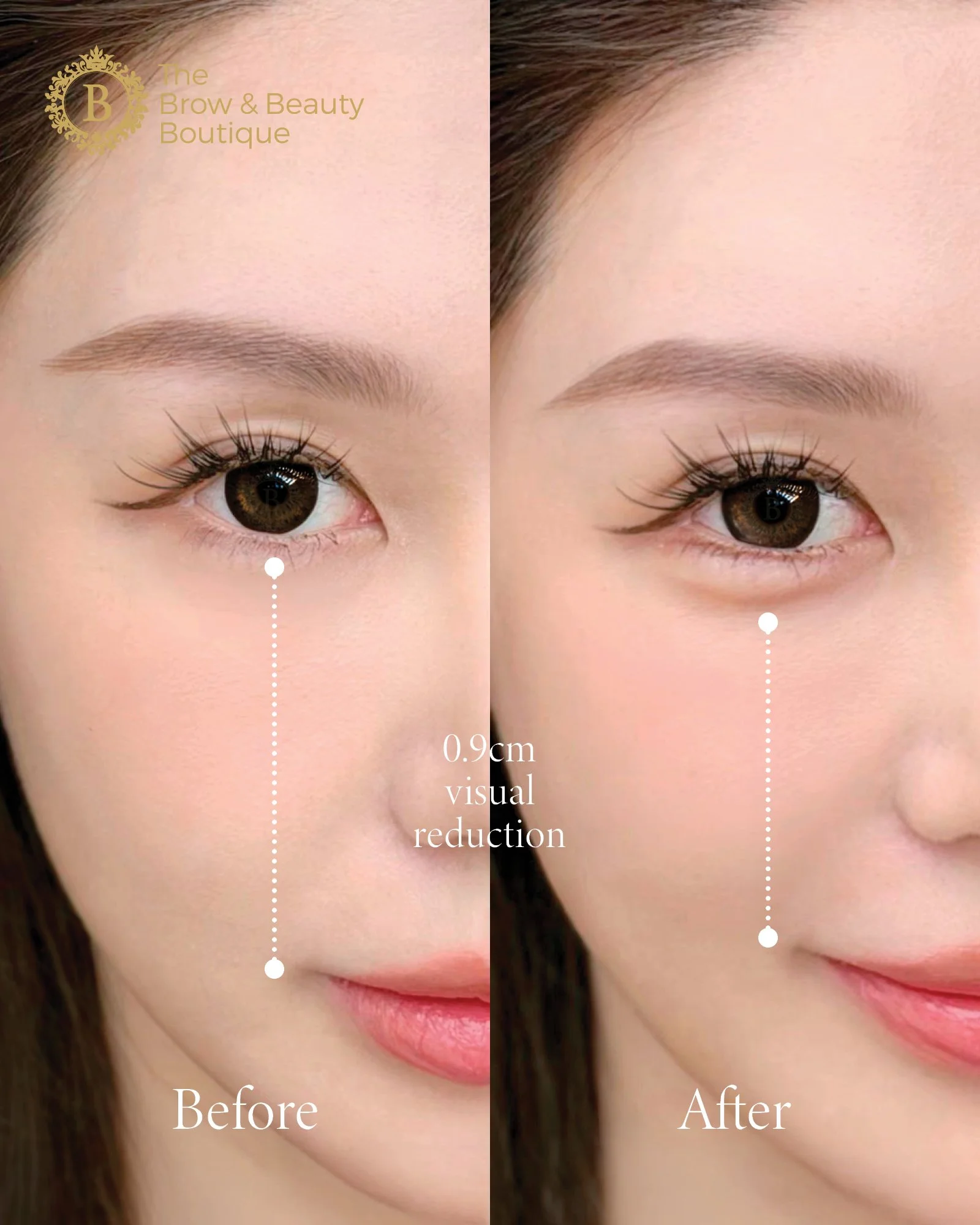 Aegyo-Sal Shading 柔雾卧蚕 - The Brow & Beauty Boutique20.jpg