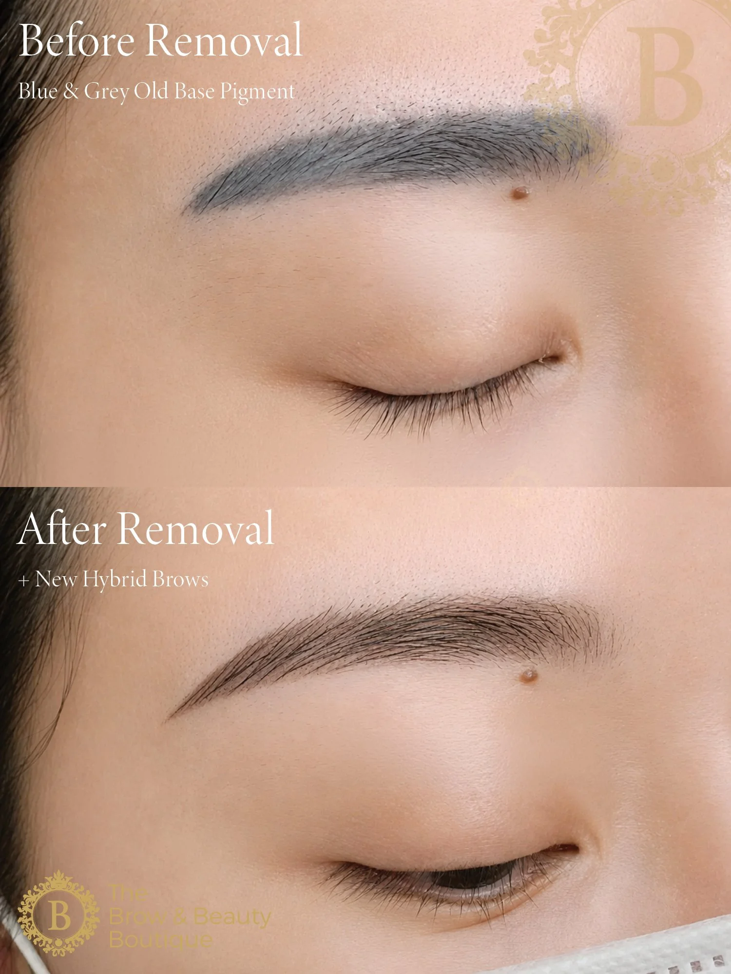 RF PULSE eyebrow Removal by The Brow & Beauty Boutique3.jpg