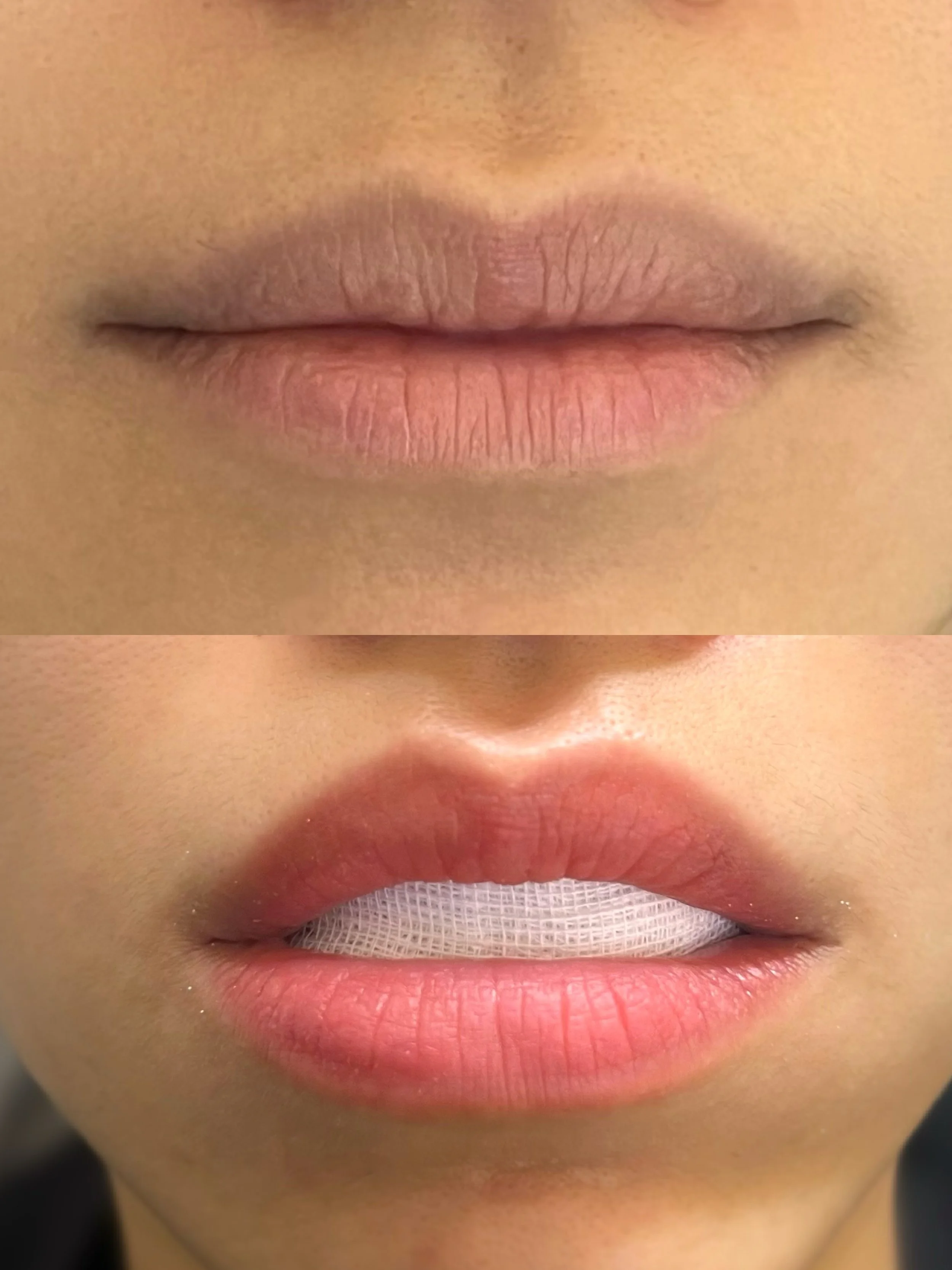 Lip_Blush_ before & after 87655.JPG