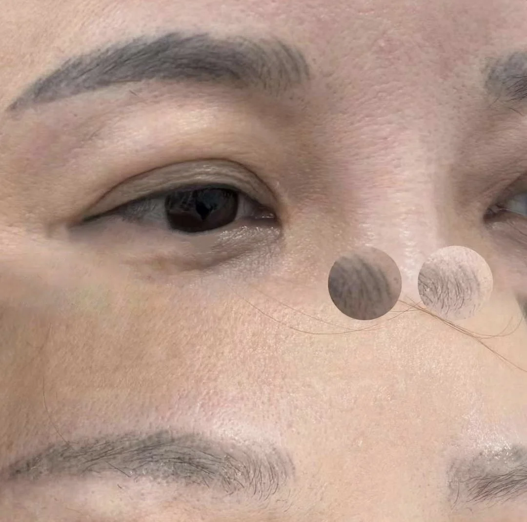 Removal_removal before & after b24d2d8cc659015a23f5197e1b5aef46.jpg