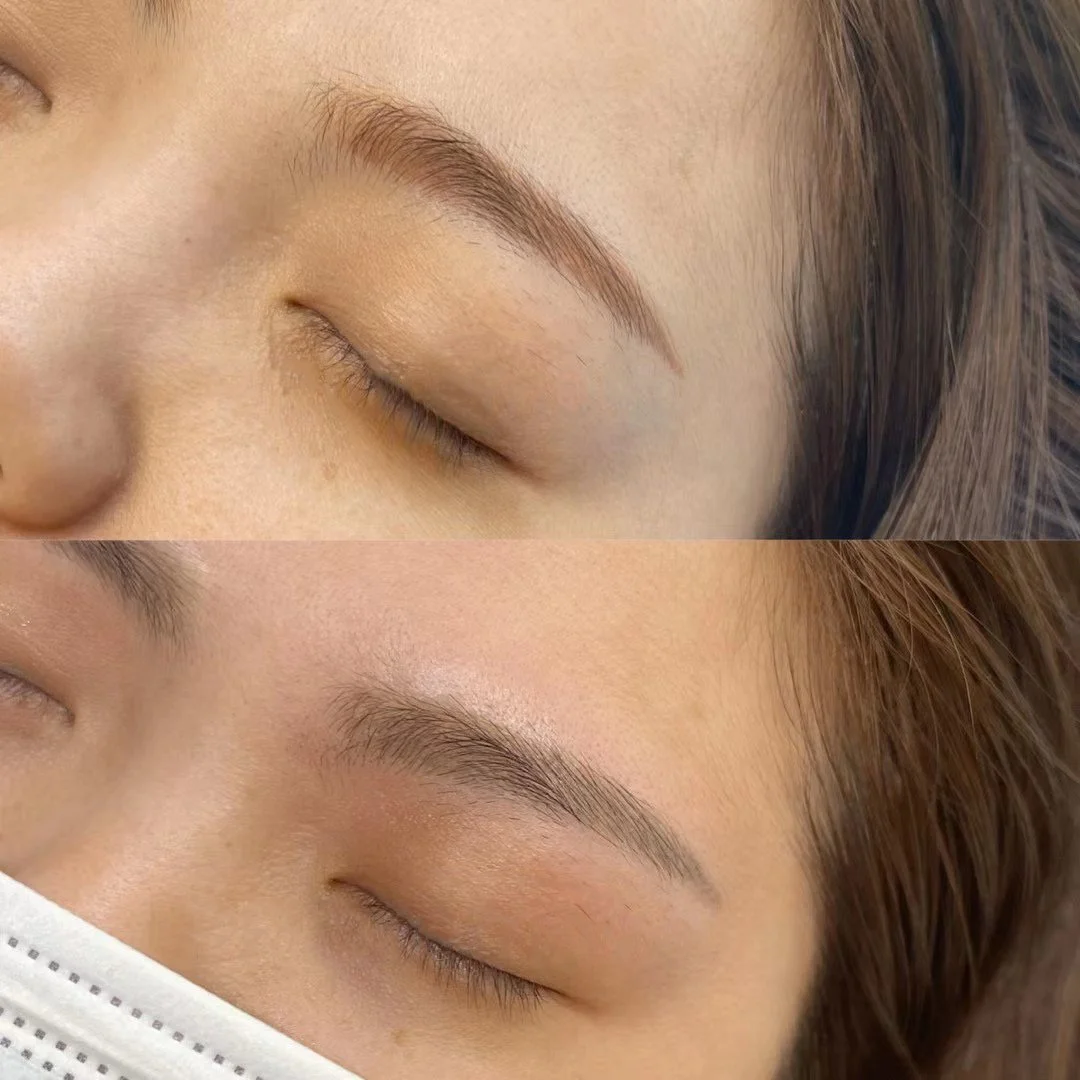 Removal_Eyebrow Removal before & after a3c802793dc58d3acc6402357fe11737.jpg