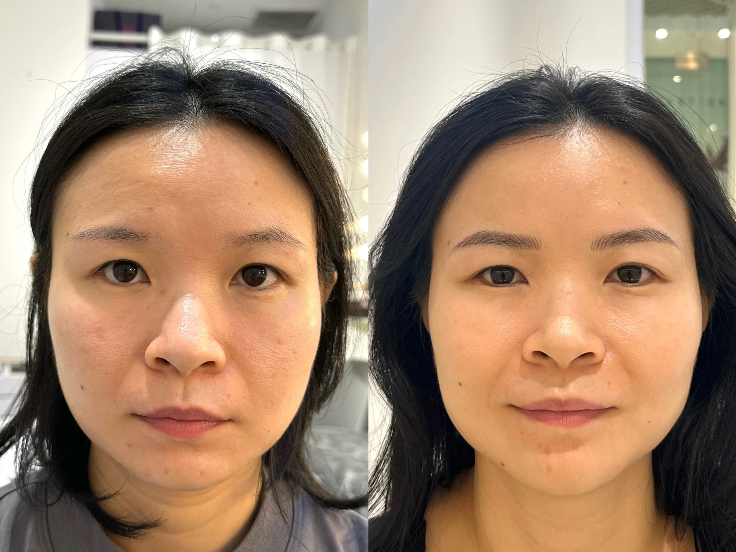 Brows_Hybrid full face before & after 4359.jpeg