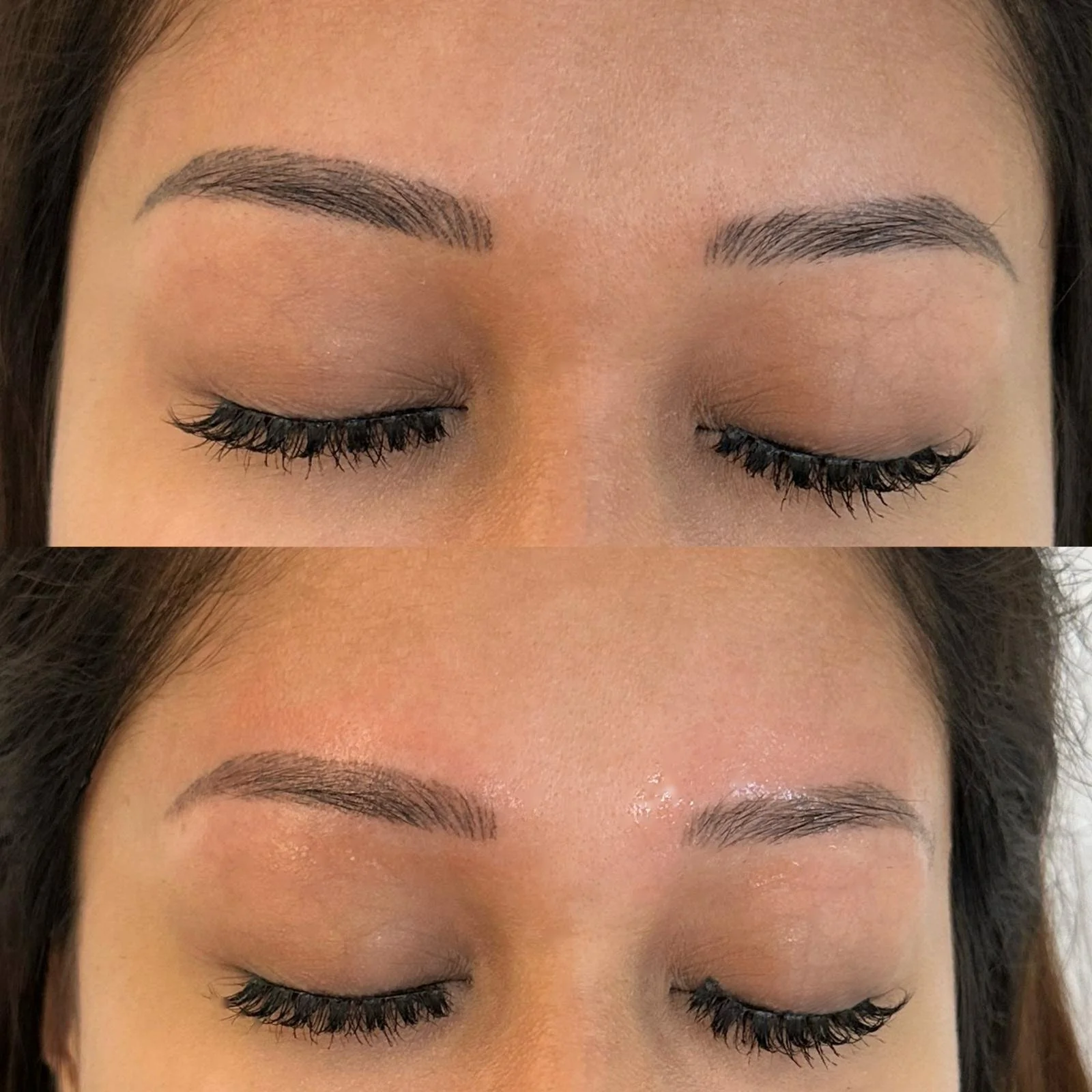 Removal_Before & After_0007 2.JPG