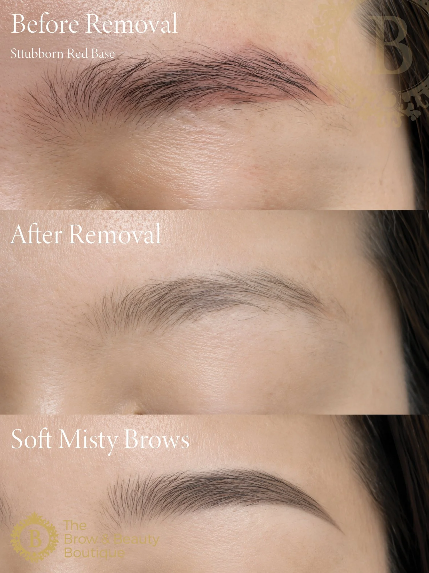 RF PULSE eyebrow Removal by The Brow & Beauty Boutique10.jpg