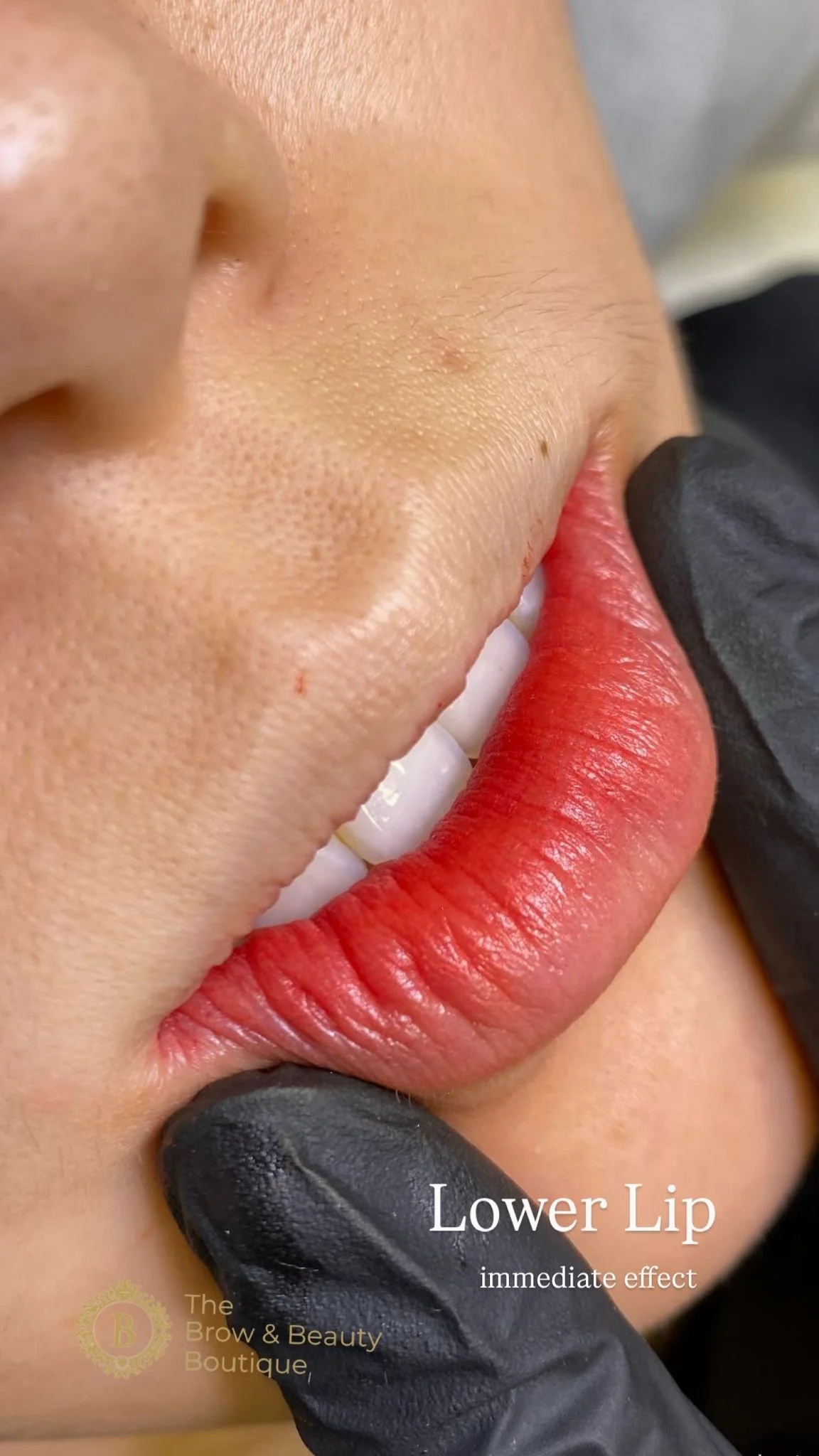 From Structural Lip Correction to Predictable Color Outcomes