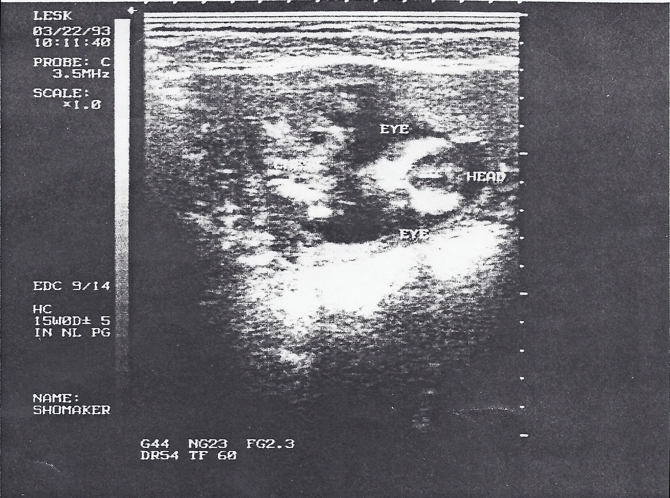 0693 Grace Sonogram 1.jpg