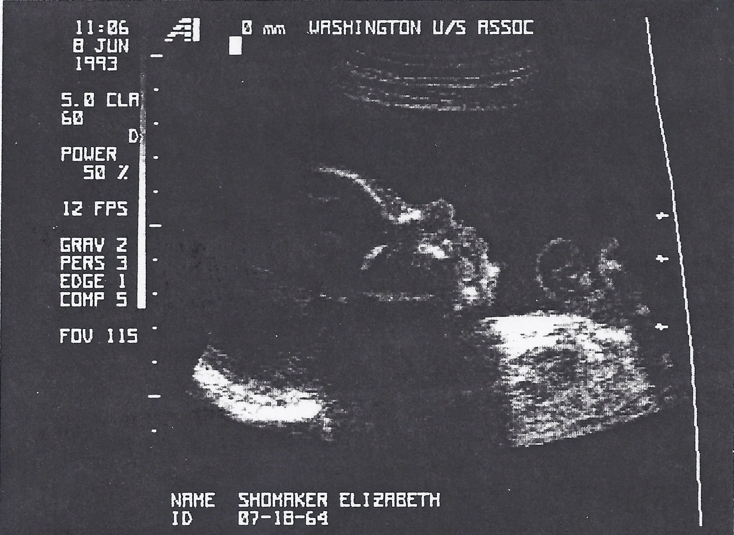 0693 Grace Sonogram 2.jpg