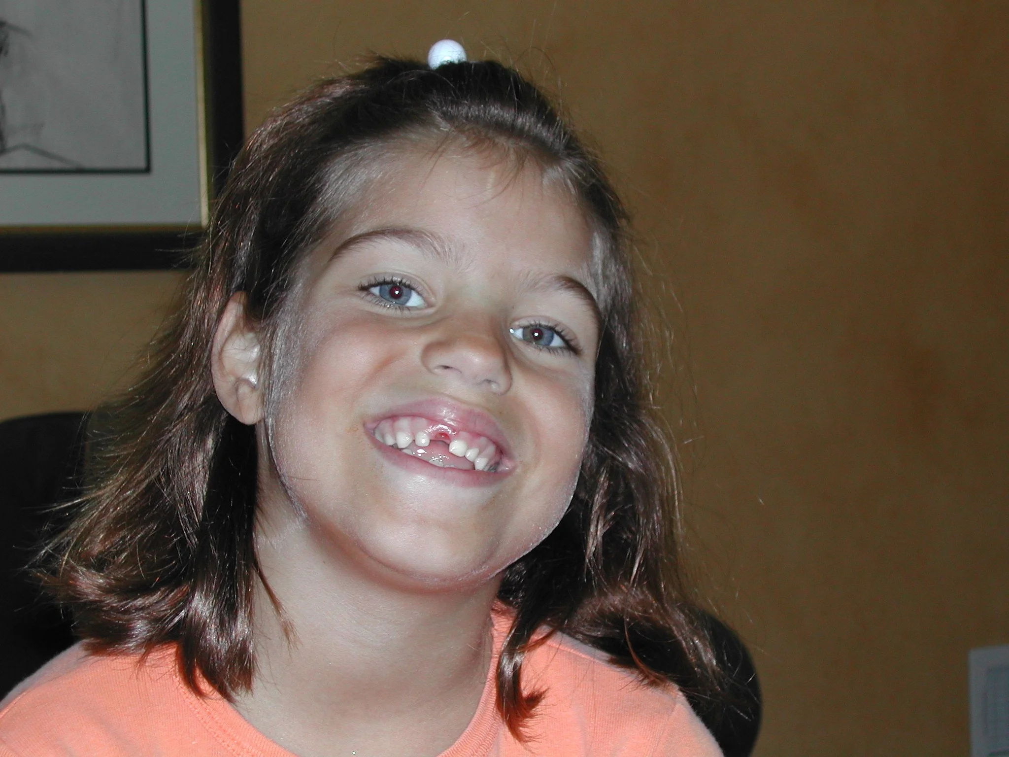 0703 Ava Minus 1 Tooth.jpg