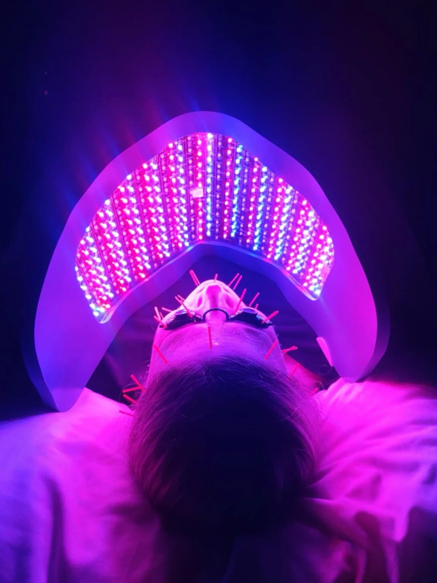 FACIAL REJUVENATION | ACUPUNCTURE + HEALING MODALITIES

Sometimes referred to as the &ldquo;non-invasive facial-lift&rdquo;, Facial Rejuvenation Acupuncture is a FULL FACE + NECK treatment that blends the foundations of Traditional Chinese Medicine w