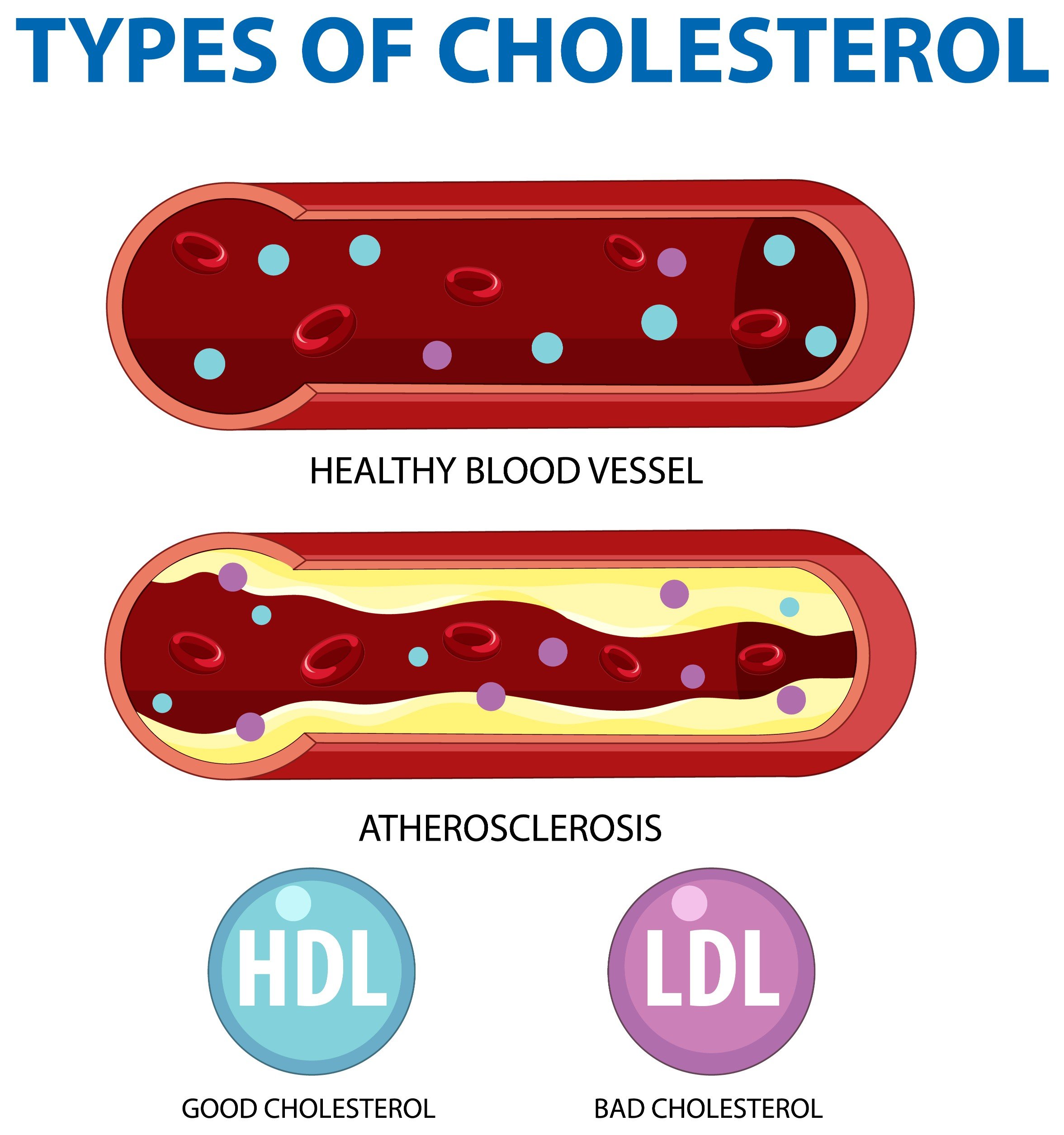 10 Foods That Can Lower Your Ldl (“Bad”) Cholesterol Levels Naturally —  Novi Health