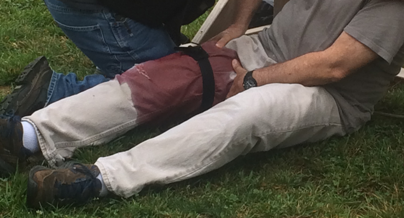 giant conduct bleeding