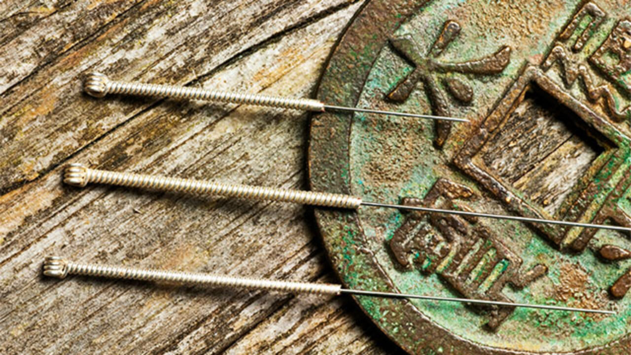 The-Finer-Points-of-Acupuncture-1280x720.jpg