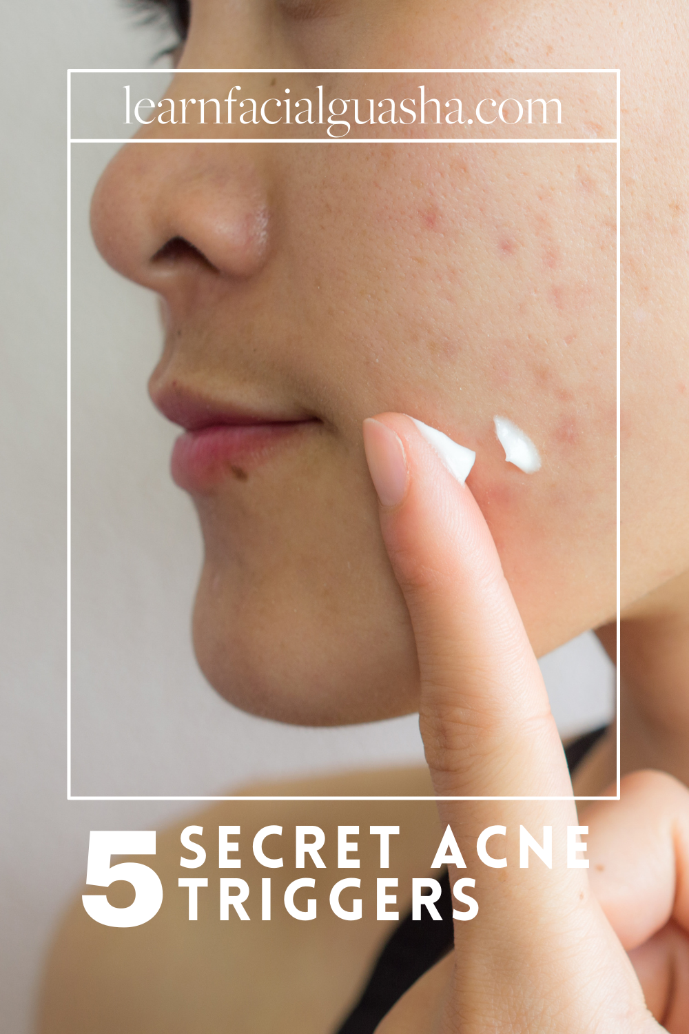 Secret Acne Triggers — GLŌ Method™