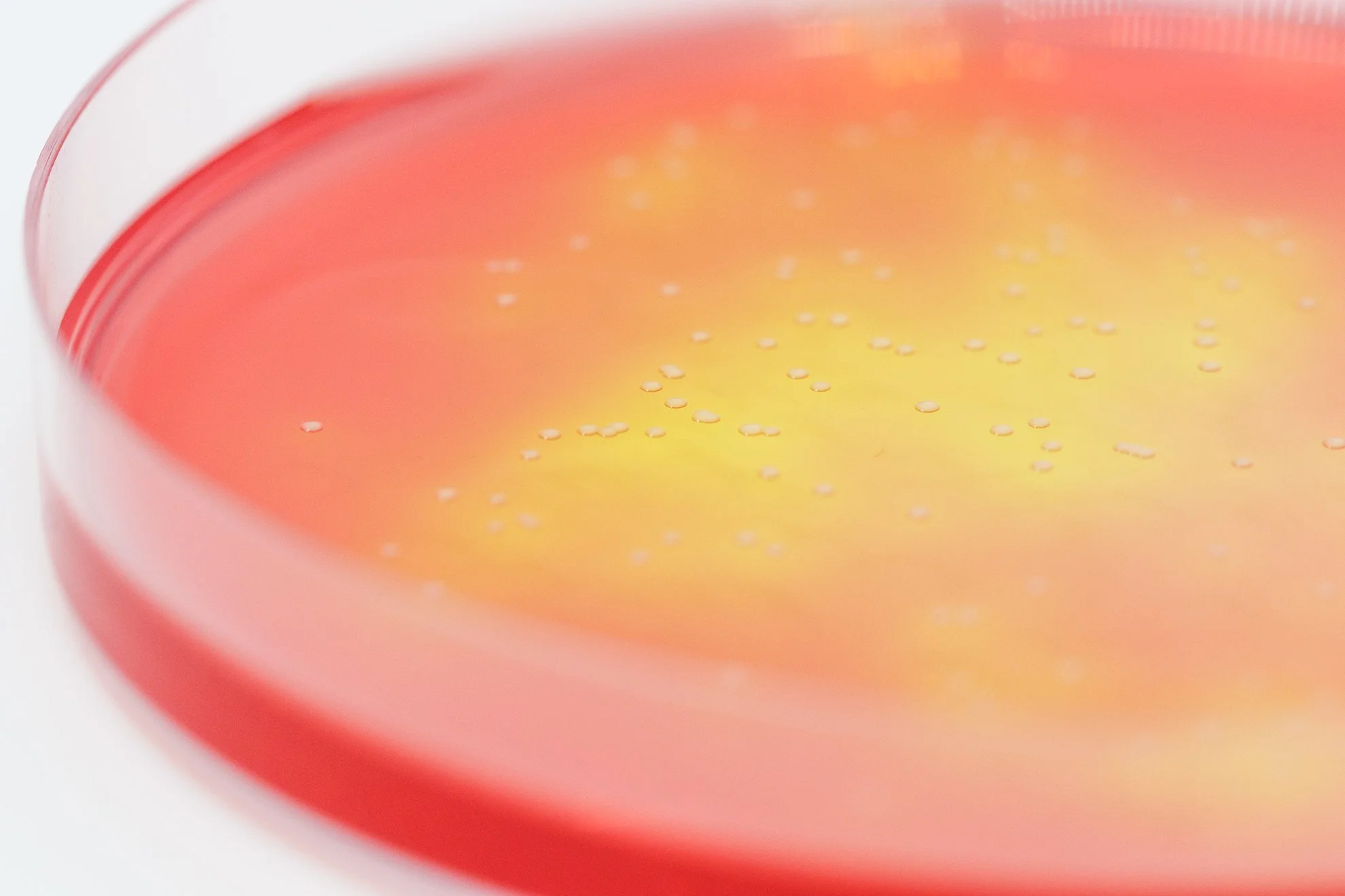 Microbiology-Growth-Plate-Red-Yellow.jpg