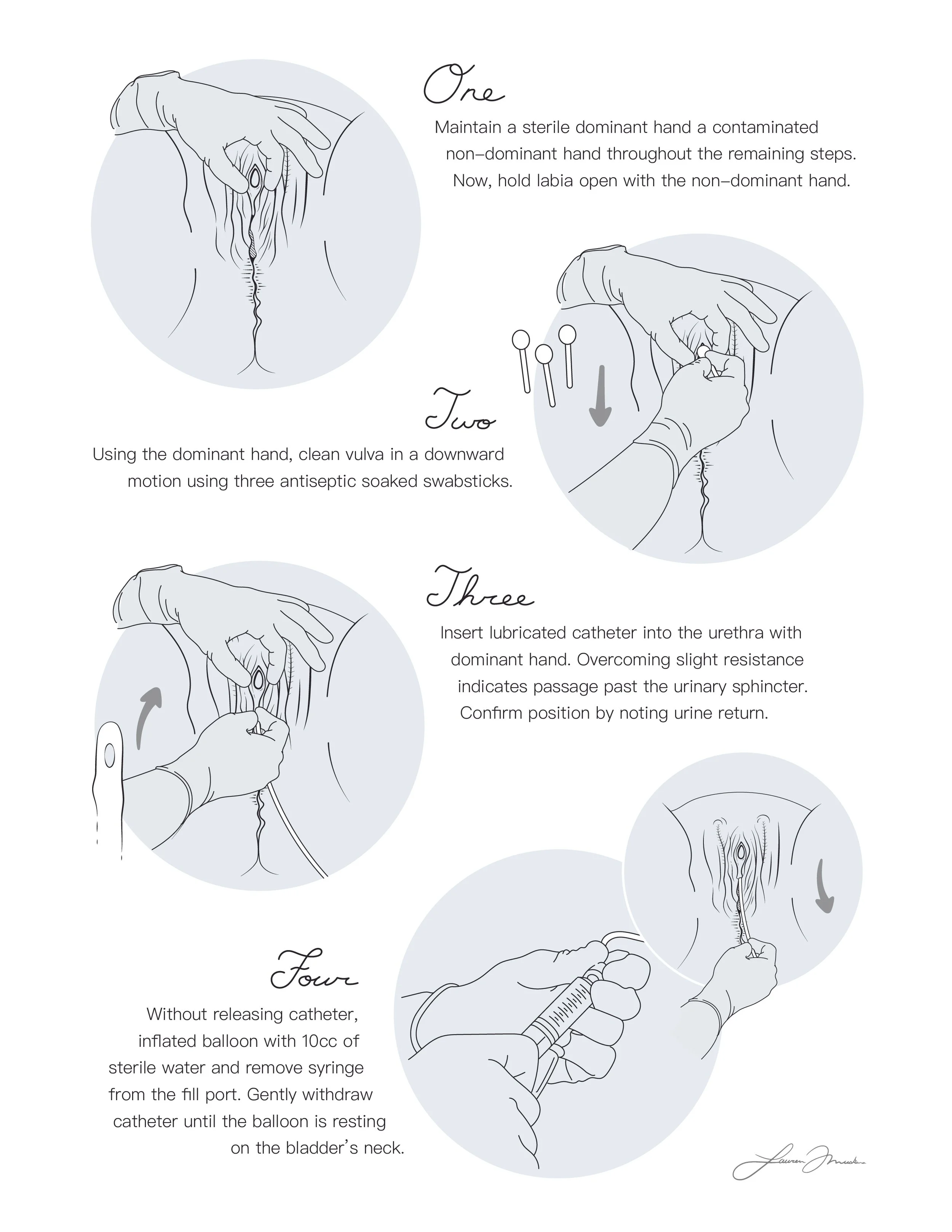  Foley catheterization on trans-feminine patients , page 2 