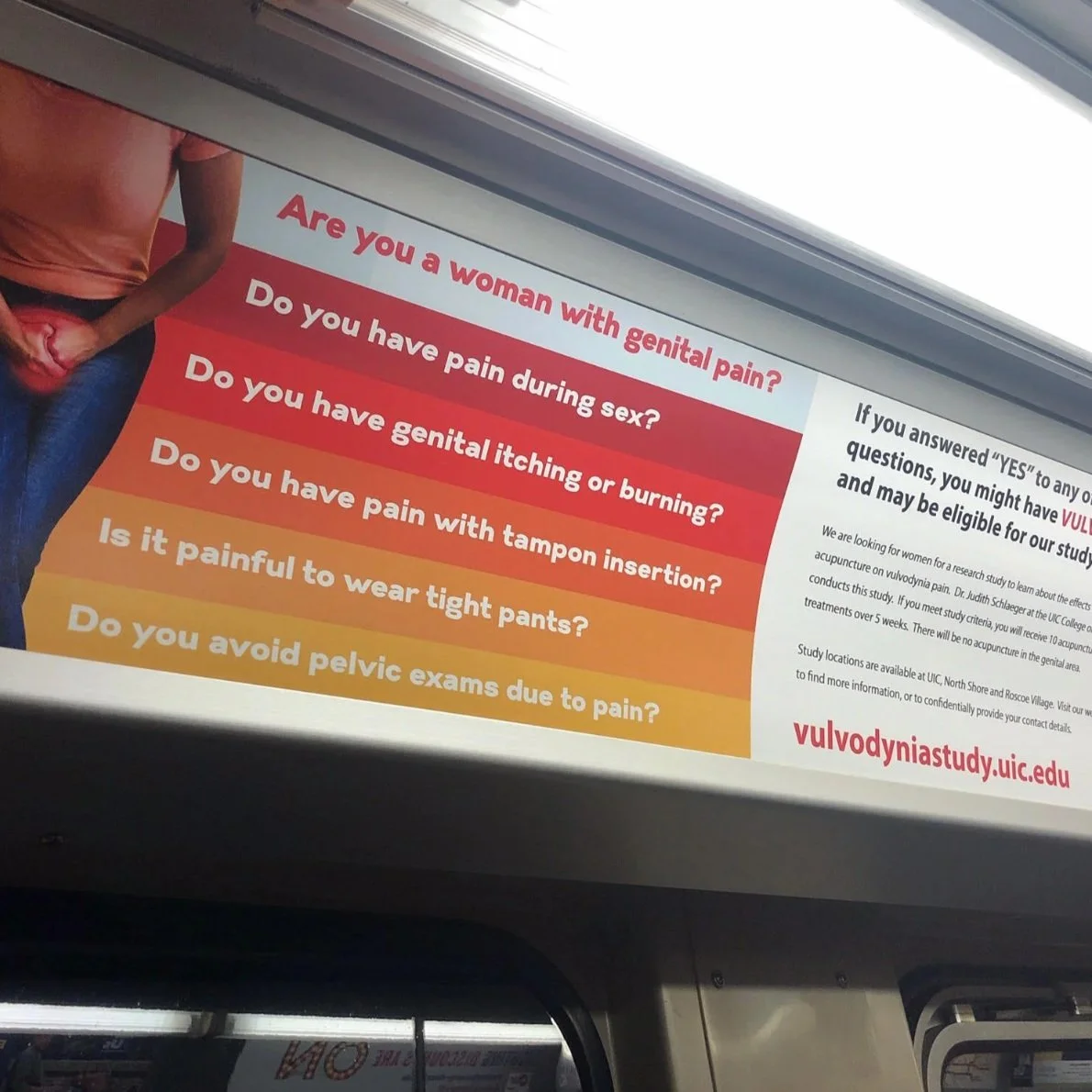 UIC Study Marketing - Vulvodynia