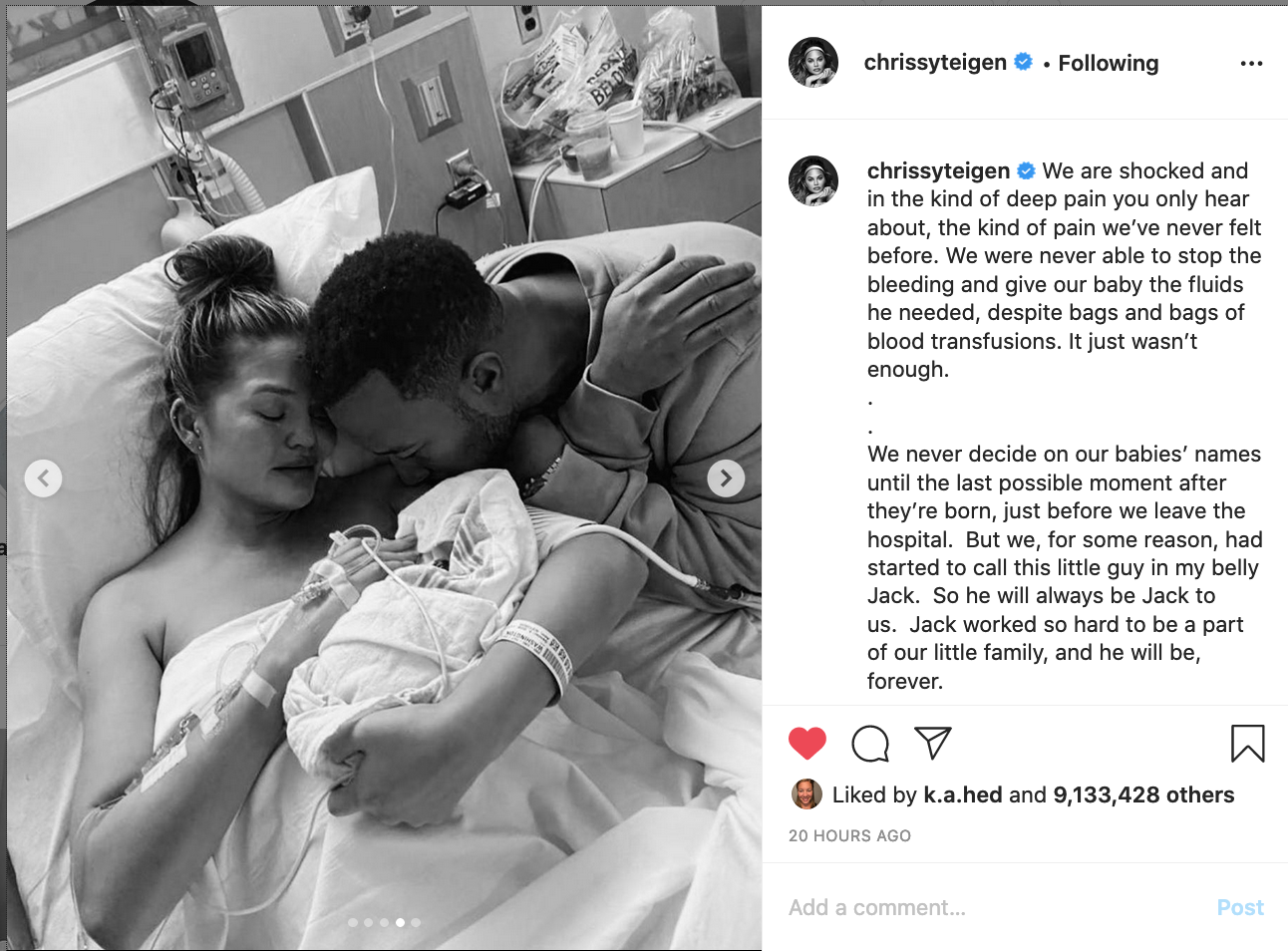 What's Wrong With Chrissy Teigen Posting About Her Miscarriage? — Friday  Things