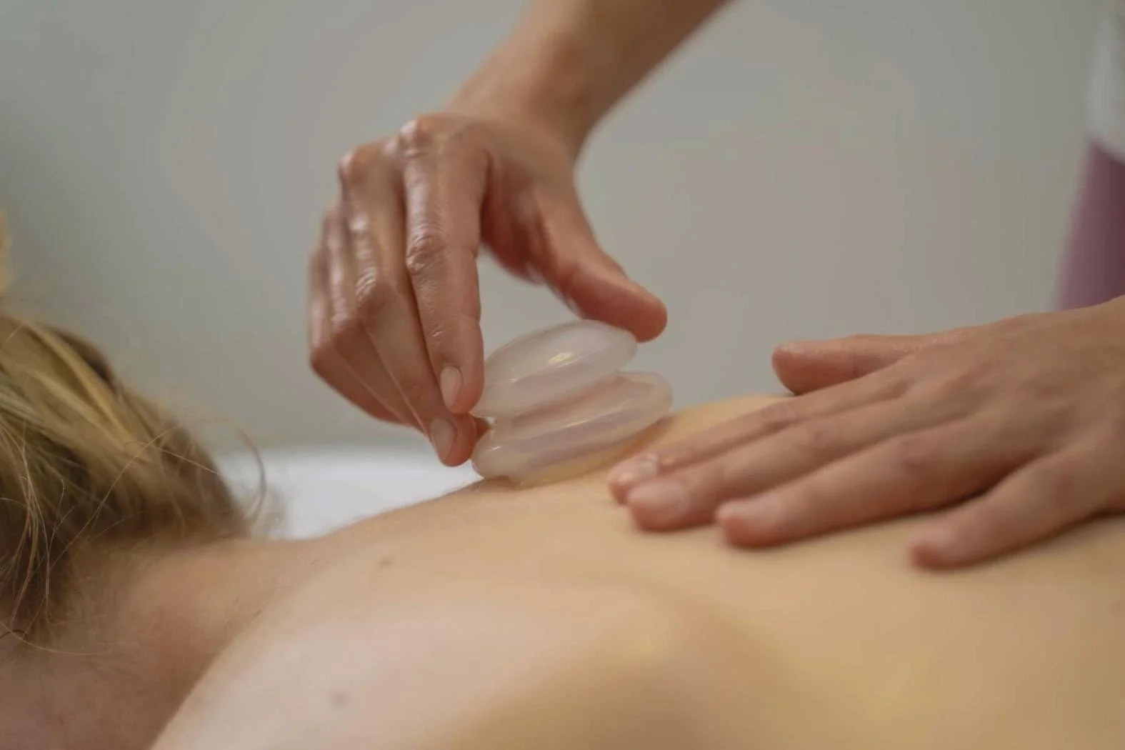 A practitioner using a cupping tool on a persons back using their hands