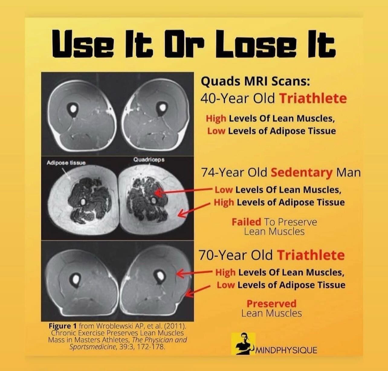 Use It or Lose It 💪

These MRI scans highlight how powerfully the body adapts to our daily choices or lack thereof.

📊 What you&rsquo;re seeing:
&nbsp;&nbsp;&nbsp;&nbsp;&bull;&nbsp;&nbsp;&nbsp;&nbsp;40-year-old triathlete: high lean muscle, low adi