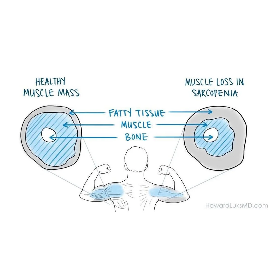 Injury doesn&rsquo;t just &ldquo;hurt&rdquo;&hellip; it can literally change what your muscles are made of. 👀

This image shows the difference between healthy muscle vs. muscle loss (sarcopenia)&mdash;where:
✅ Muscle cross-section shrinks
✅ Fatty ti