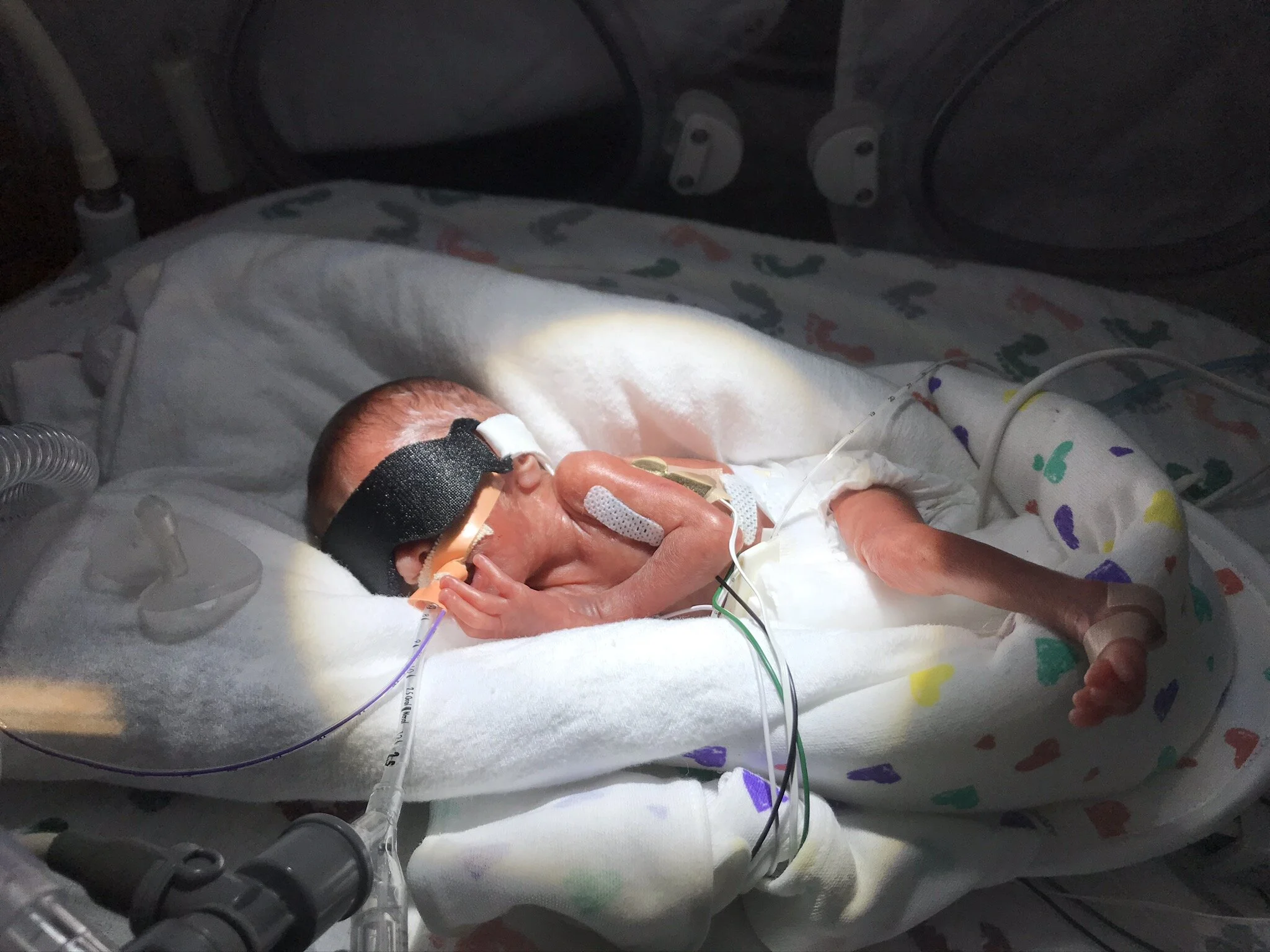 Episode 3: Bailey Thoman. You Have to Have Hope in the NICU.