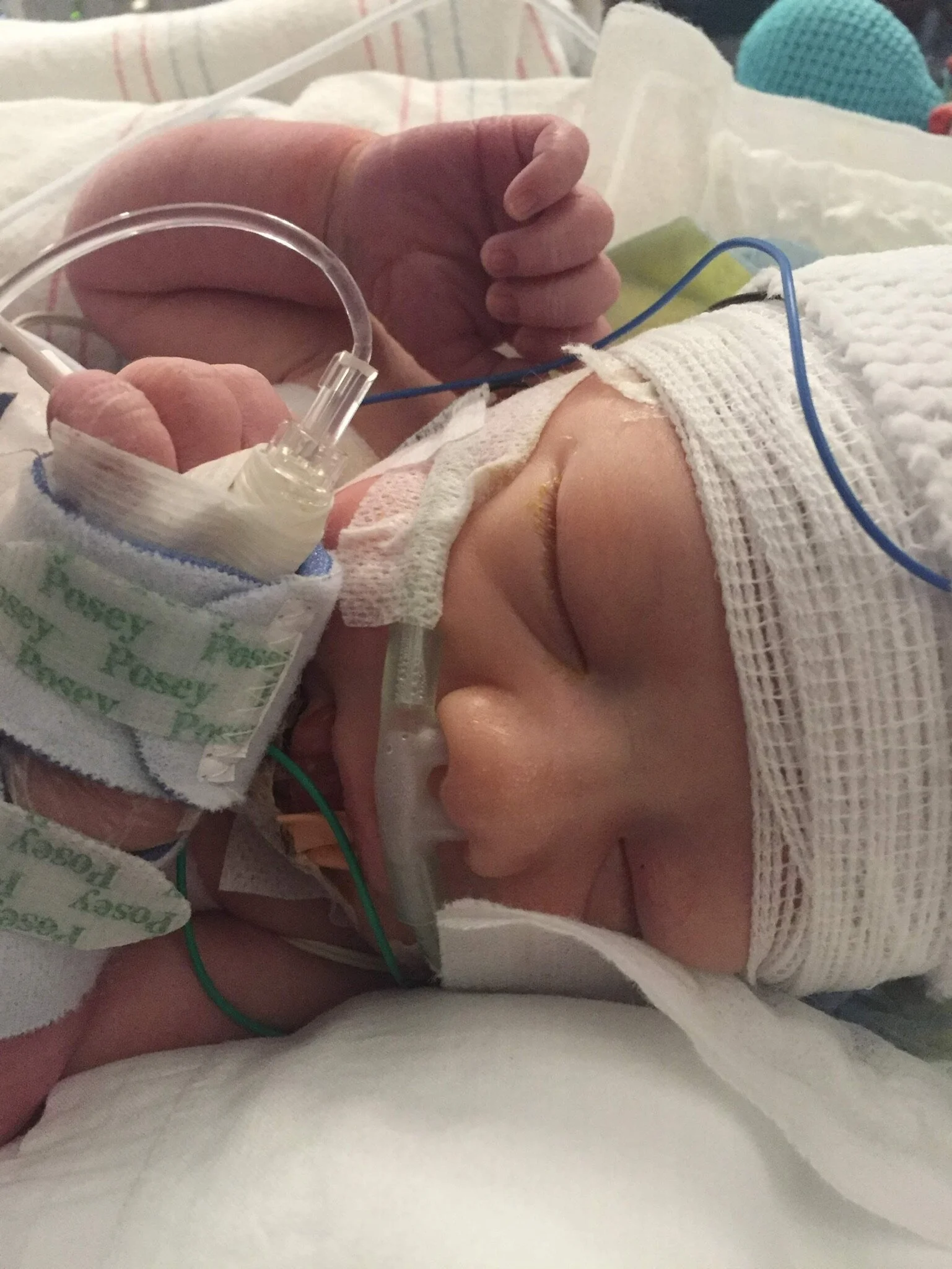 Episode 6: The Space Between. Clayton's Story - a journey of Hypoxic-Ischemic Encephalopathy (HIE).