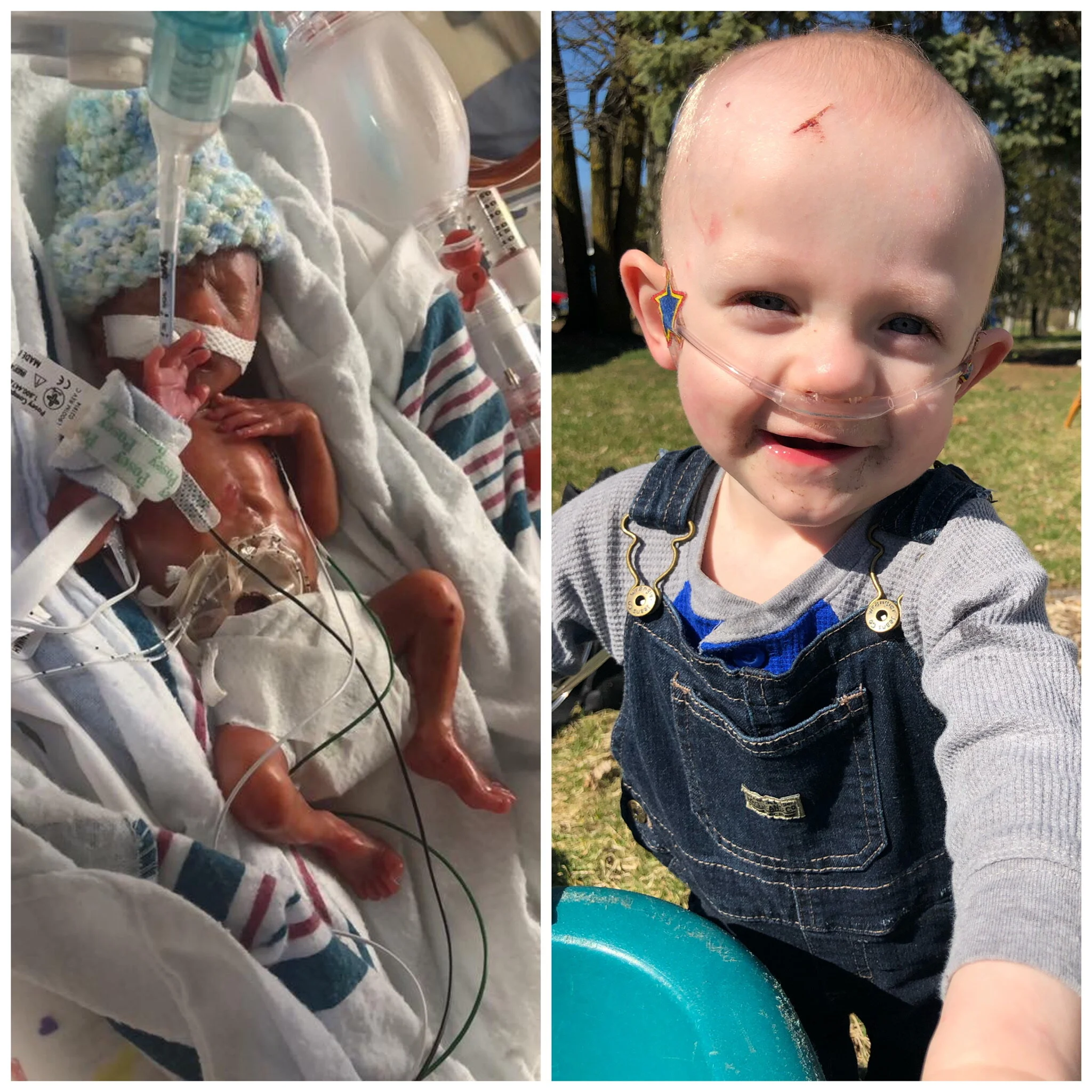 Episode 18: Catch-22. The story of Lucas, born at 22 weeks