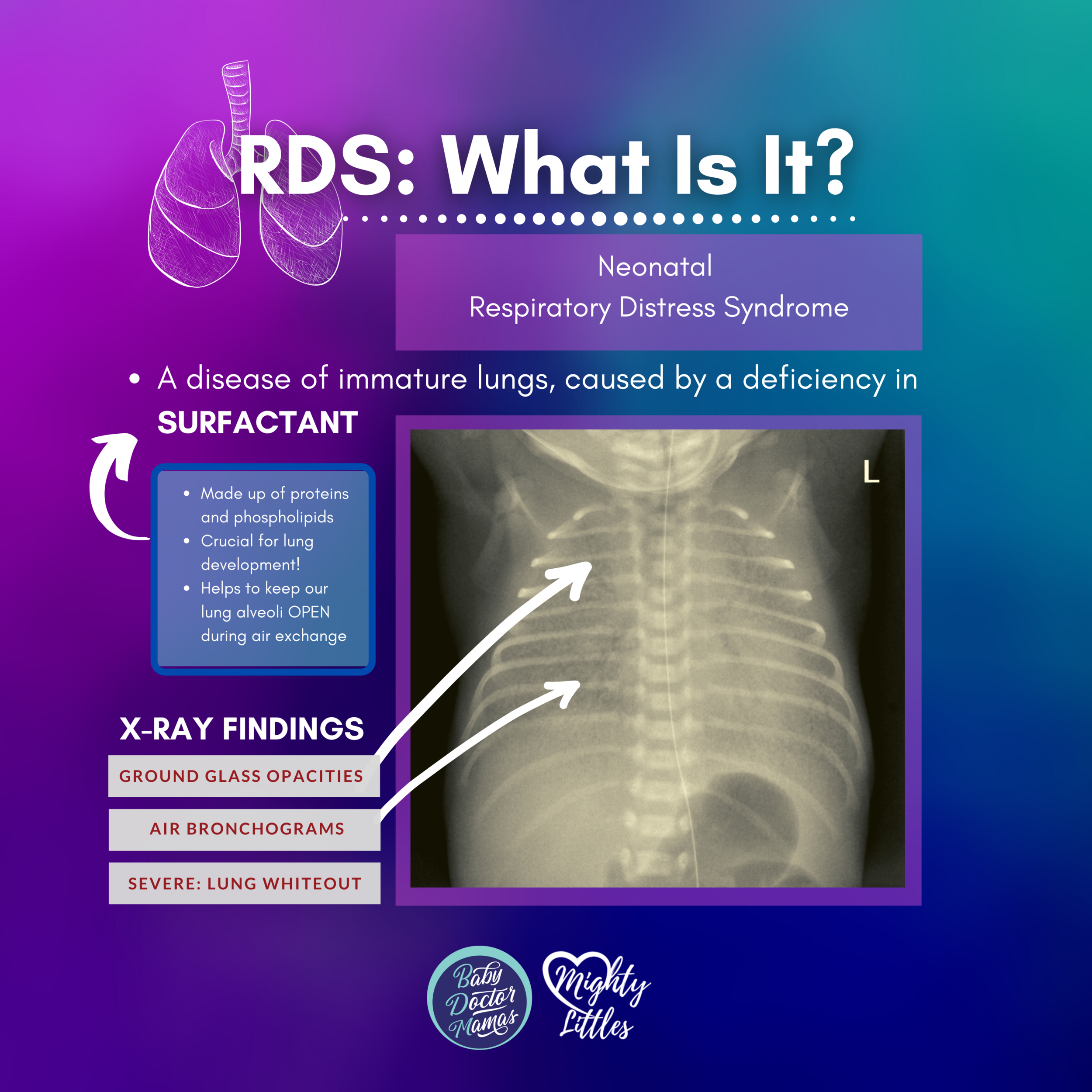 Episode 23: NICU Education: Respiratory Distress Syndrome (RDS) in the NICU