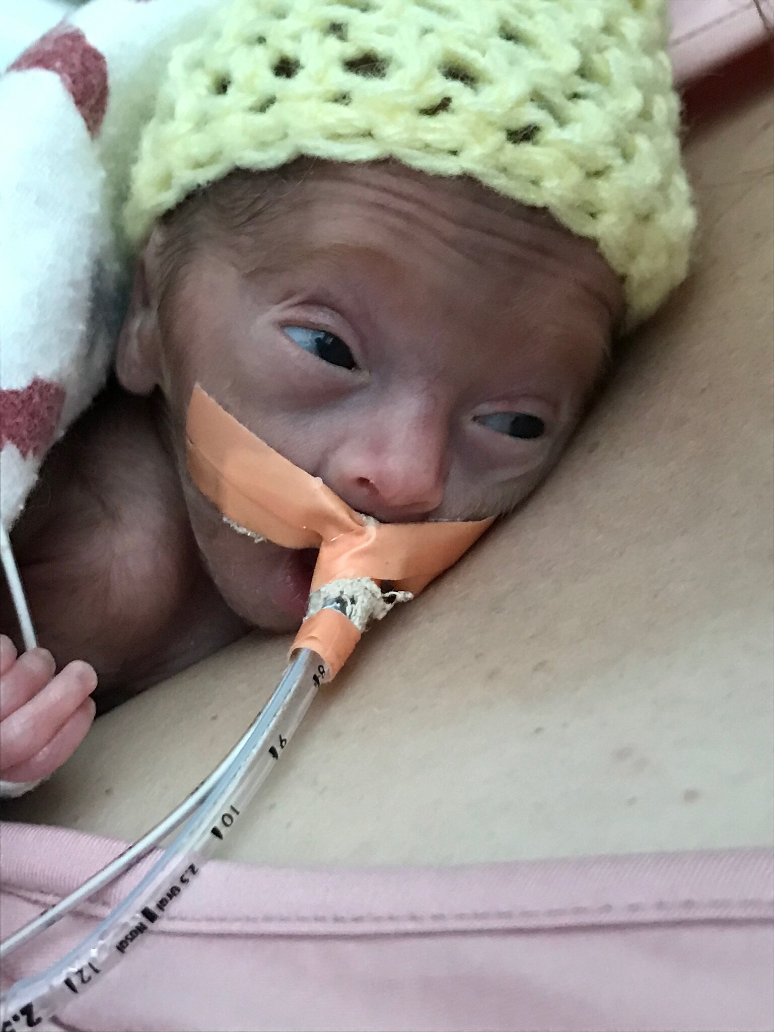 Episode 26: Practical Parenting - Focus on Touch Part 2 - Kangaroo Care in the NICU