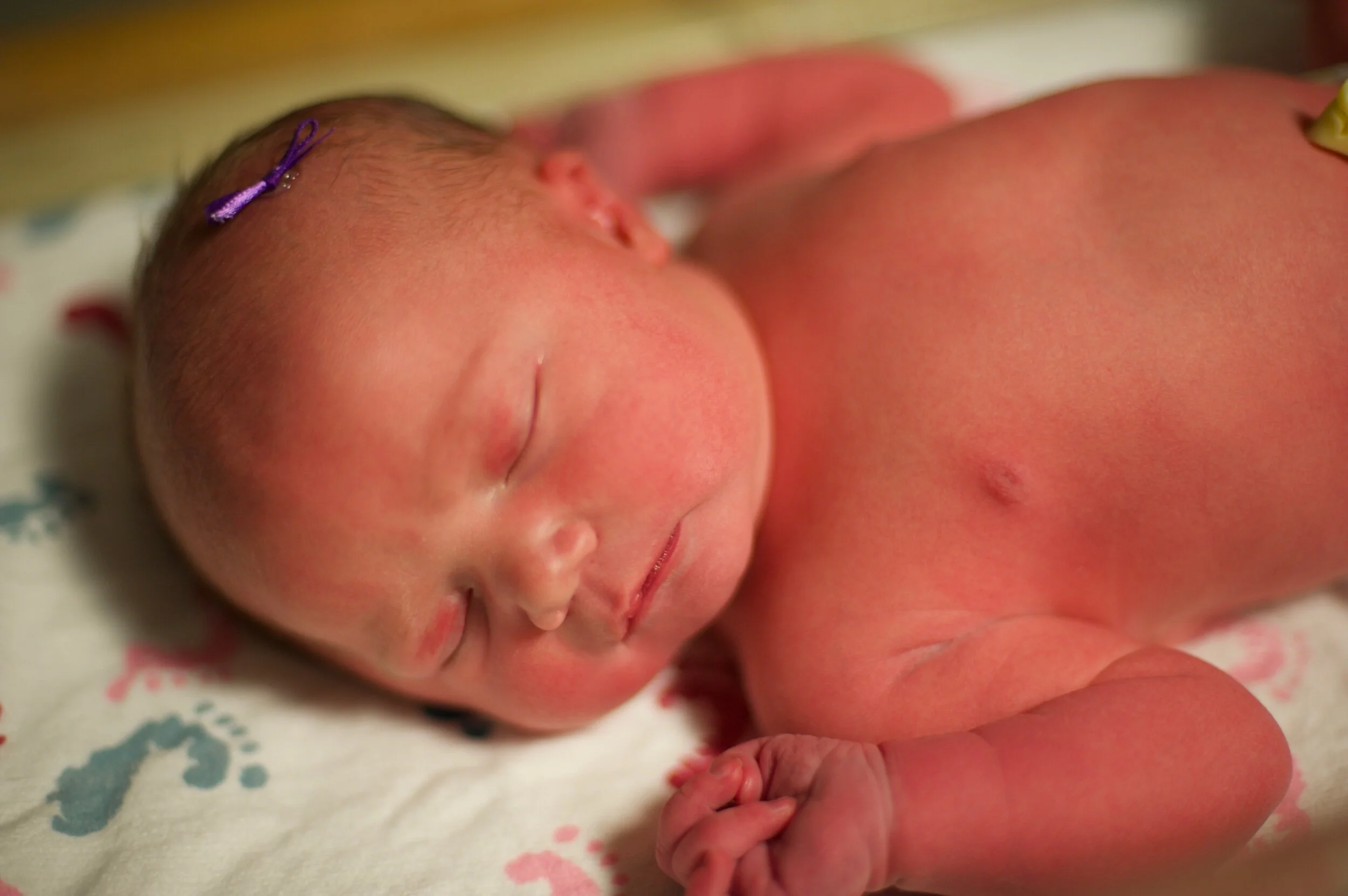 Episode 35: Does My Baby's Head Look Funny. Let's Talk about Craniocynostosis and Plagiocephaly