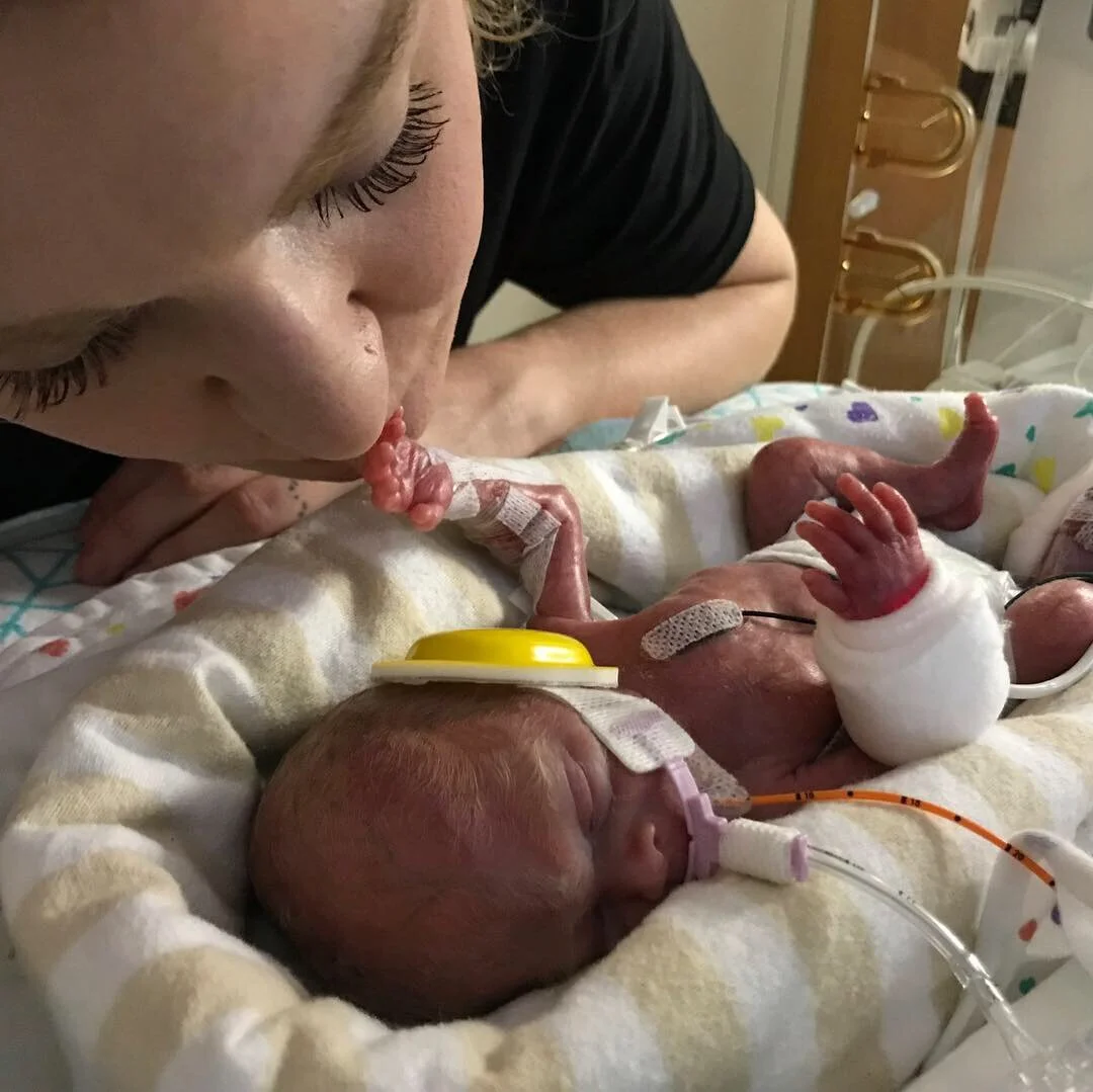 Episode 39: Gretchen's NICU experience and life after the NICU.
