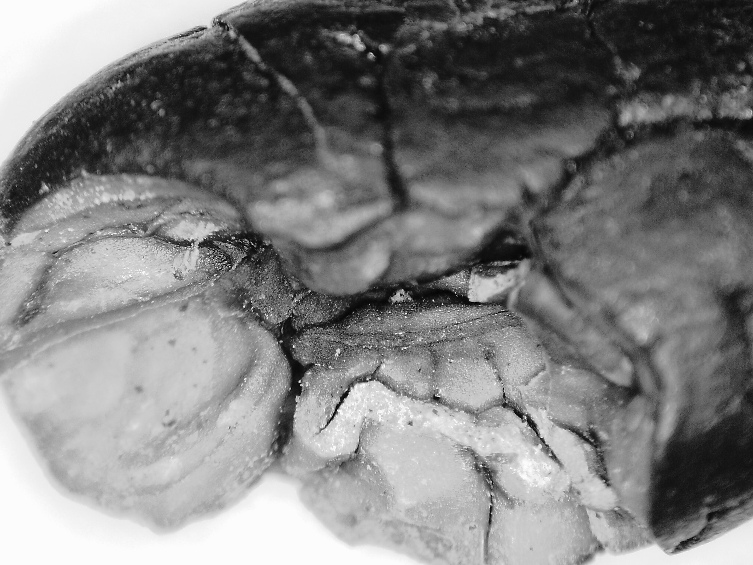 Oxalates, Chocolate, & Kidney Stones