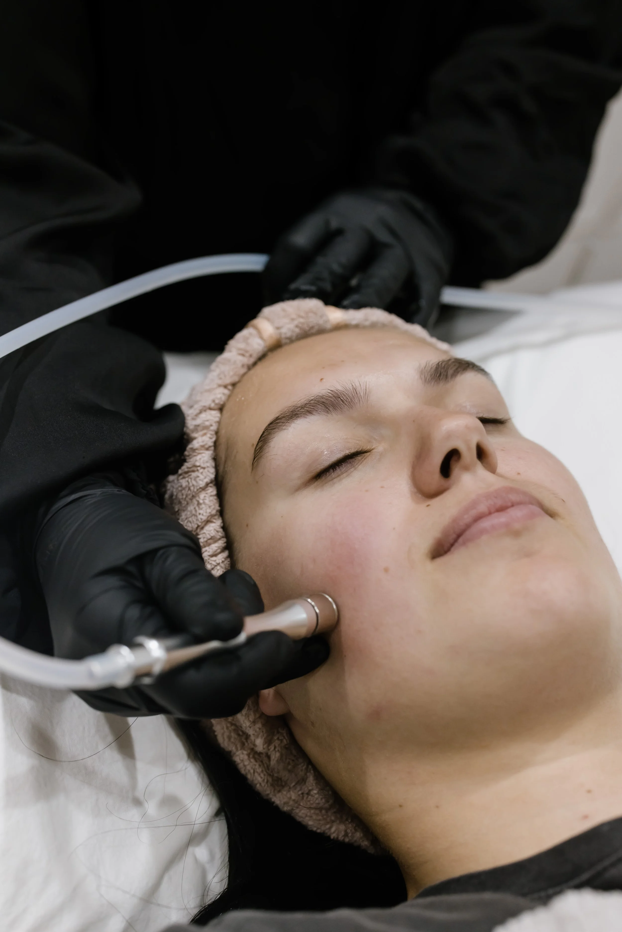 Microdermabrasion Geelong Skin Exfoliation — Bonny Skin Studio Geelong