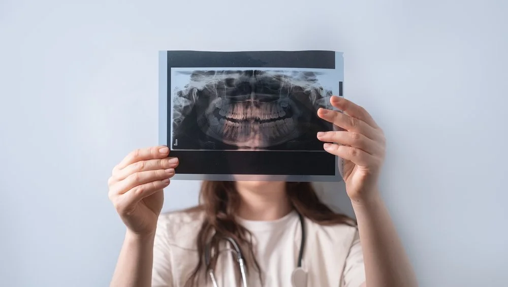 Digital X-Rays vs. Traditional X-Rays: Why Modern Imaging Matters for Surrey Patients