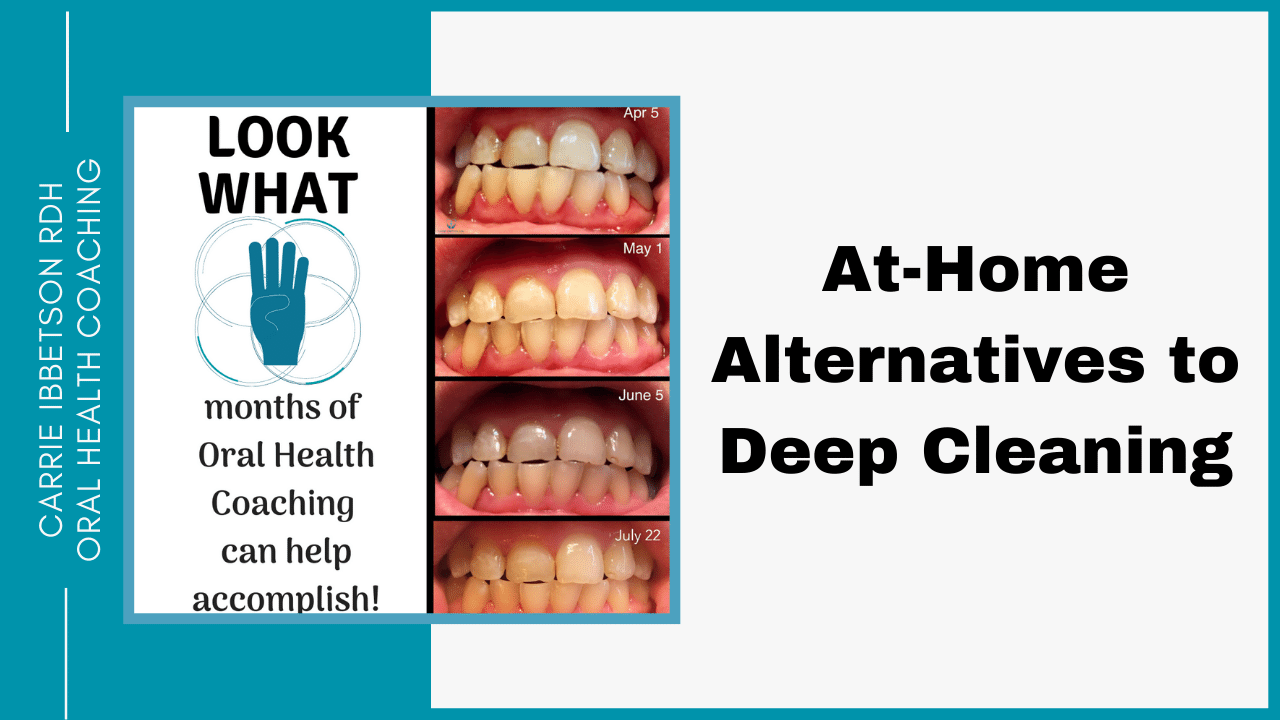 The Truth About Dental Deep Cleaning: Alternatives for a Healthy Smile —  Carrie Ibbetson RDH