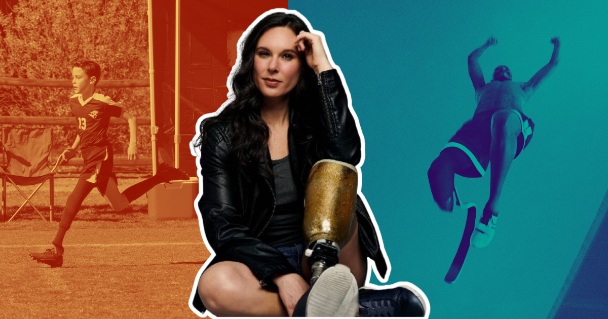 Curation Corner: Authentic Amputees