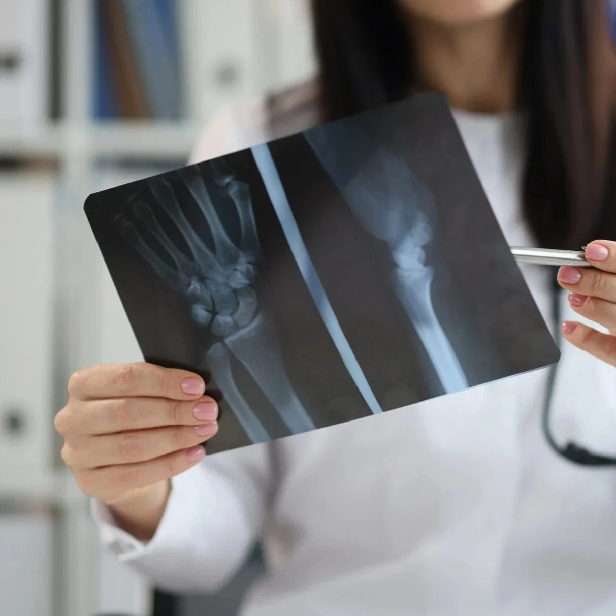 doctor-traumatologist-examines-xray-with-arm-injury-closeup.jpg